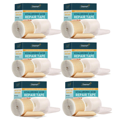 🍍Official Store |Cheemex® Hyaluronic Acid Nano Microneedle Repair Tape🗽🎉(Treatment of old and new scars, reduction of surgical scars, stretch marks, keloids, acne, burns, warts, dermatomes and varicose veins)