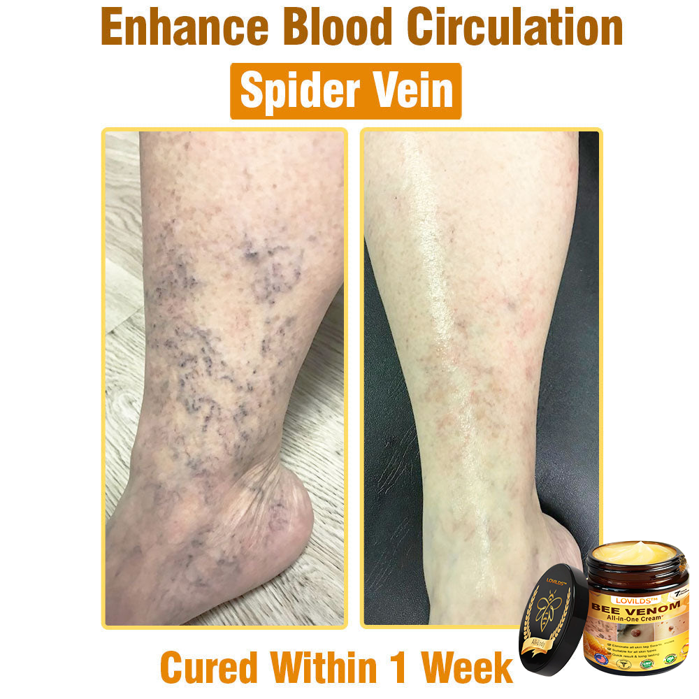 LOVILDS™ Bee Venom Cream – 🌸 Anti-Aging, Hydrating & Skin Repair