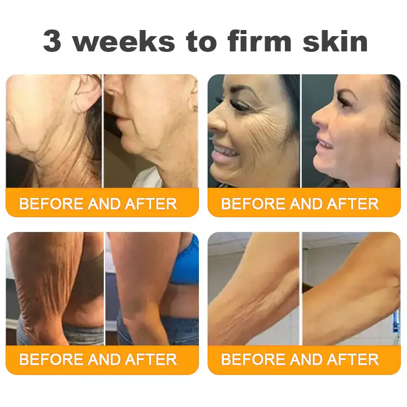 LOVILDS™ Bee Venom Cream – 🌸 Anti-Aging, Hydrating & Skin Repair